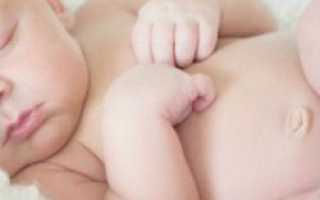 Какие встречаются грыжи у новорожденных и способы их лечения