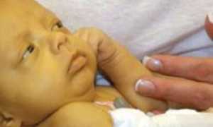 Лечение желтушки у новорожденных в домашних условиях
