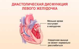 Диастолическая дисфункция левого желудочка 1 типа