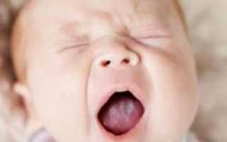 Белый налет на языке у младенца