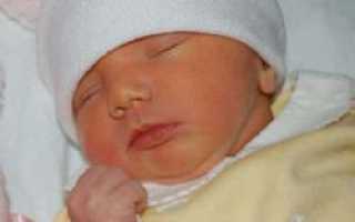 Почему возникает желтуха у новорожденного, ее признаки и последствия