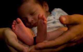 Перинатальное поражение нервной системы у новорожденных (ППЦНС)
