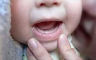 Какие могут быть симптомы прорезывания зубов у младенца?