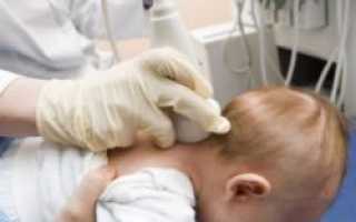 Нейросонография для диагностики заболеваний у новорожденных