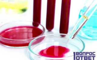 РФМК в анализе крови: что это такое, нормы
